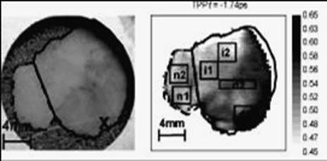 ̫��Ɲ����(x��)��